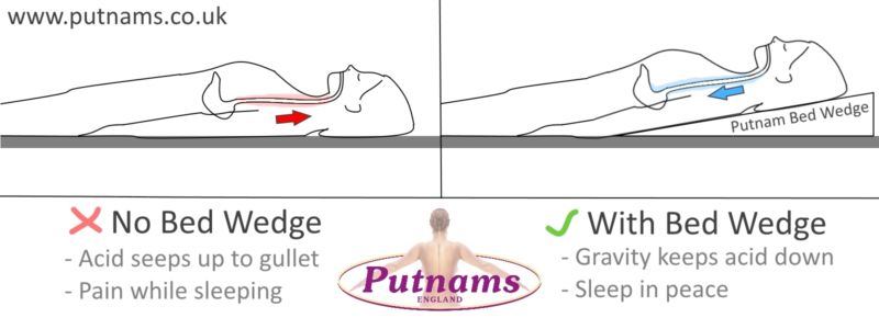 Putnams Bed Wedge - Acid Reflux graphic