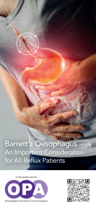 Barrett's Oesophagus Leaflet
