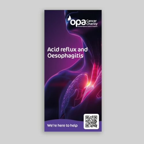 Oesophagitis is inflammation of the oesophagus lining